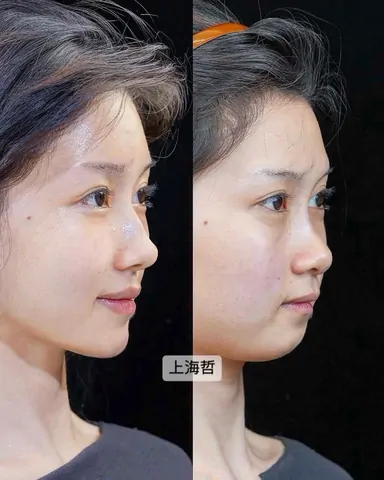 Historical Baby Face case archive image 29