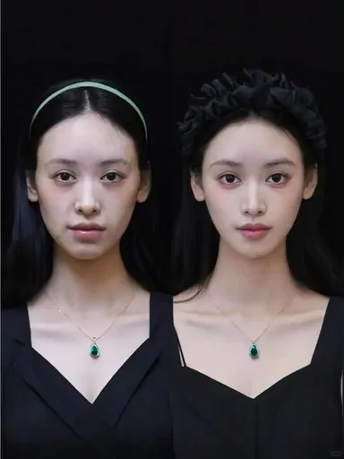 Historical Baby Face case archive image 25