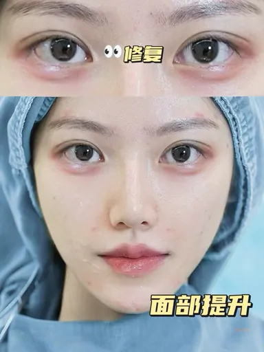 Historical Baby Face case archive image 35