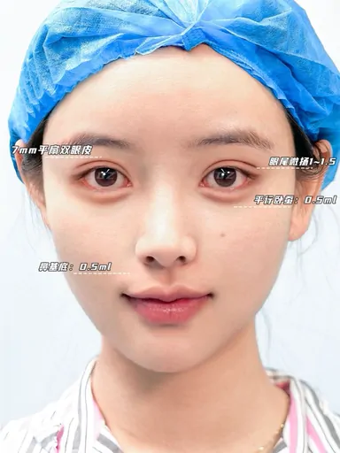 Historical Baby Face case archive image 51