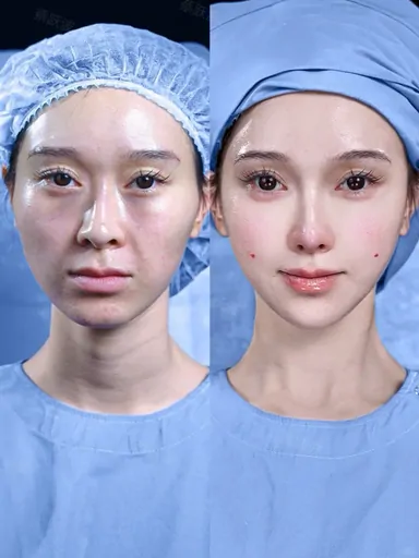 Historical Baby Face case archive image 36
