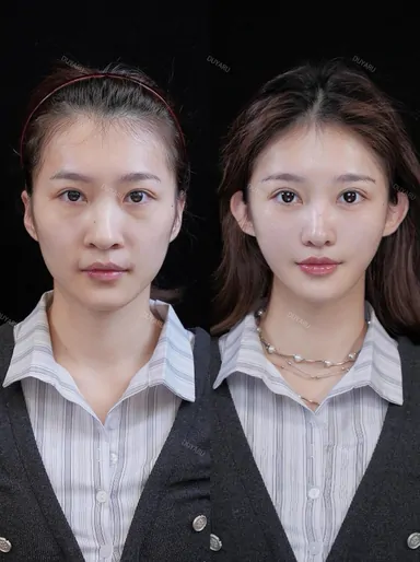 Historical Baby Face case archive image 43