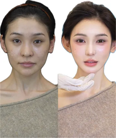 Historical Baby Face case archive image 37