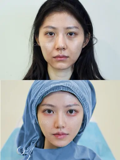 Historical Baby Face case archive image 18