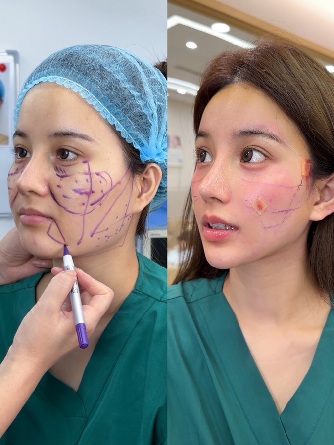 Featured treatment reference 03